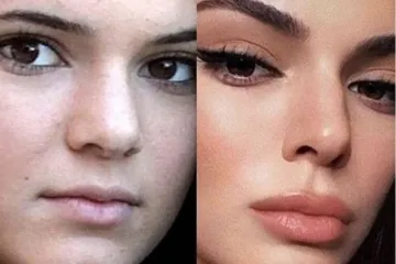 Zvijezde bez photoshopa: popularan Instagram profil optužen za maltretiranje